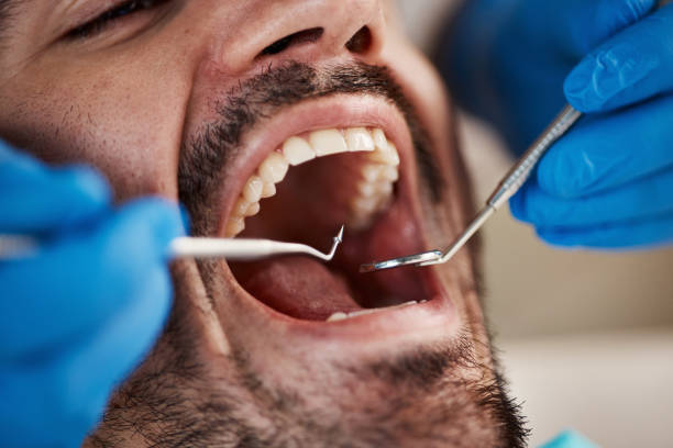 Best Emergency Denture Repair in Benbrook, TX